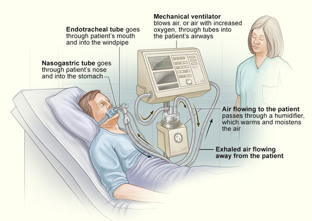 Read more about the article เครื่องช่วยหายใจ (ventilator) สำหรับสู้ภัยโควิด-19 มีหลักการทำงานอย่างไร