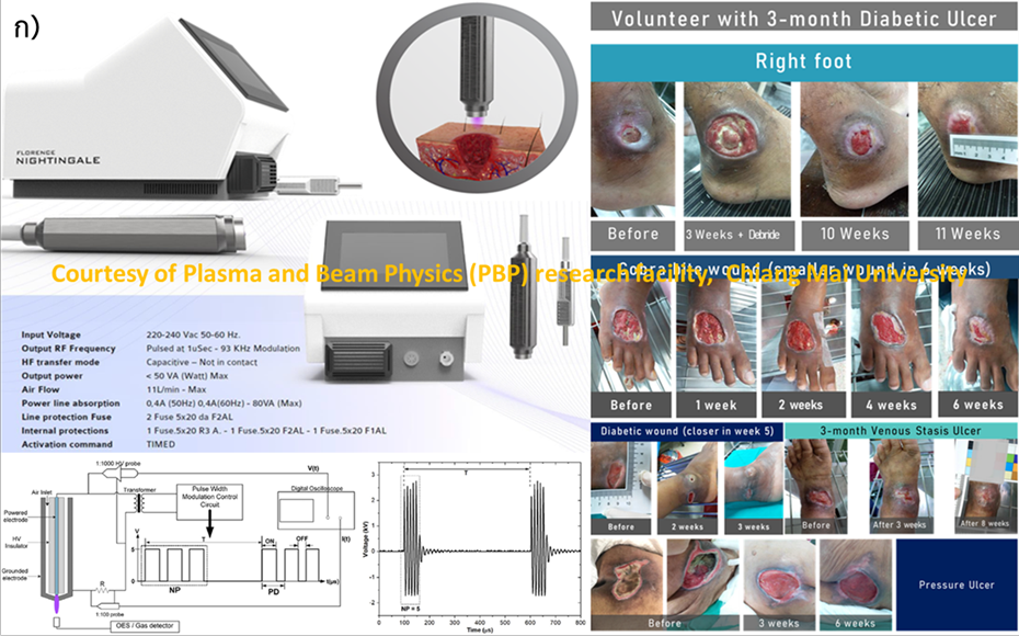 Read more about the article ปริมาณพลาสมาเย็นเพื่อการประยุกต์ด้านต่างๆ (Plasma dose for diverse application)